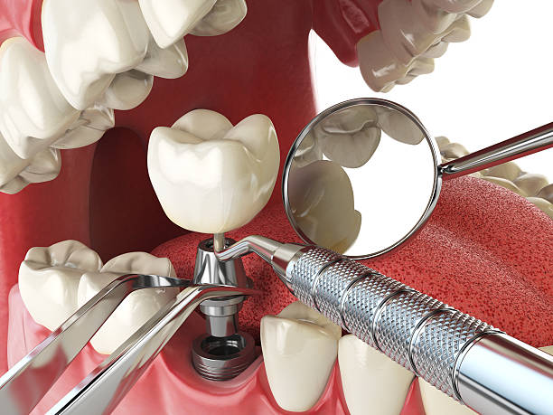 Best Emergency Tooth Extraction in Kellyville, OK